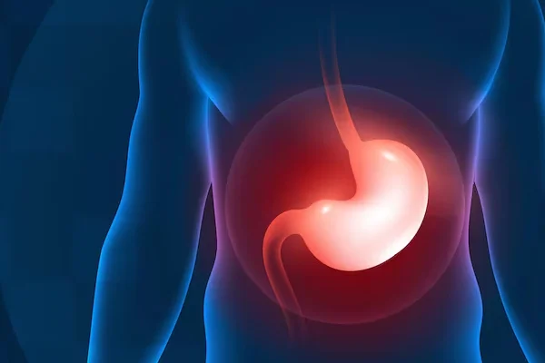 Laparoscopic Surgery for Gastric Cancer