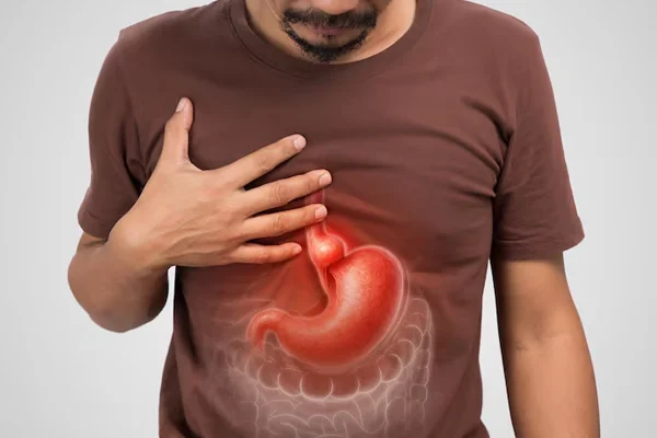 Laparoscopy for Hiatus Hernia