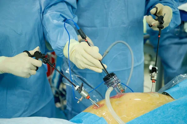 Laparoscopic Colorectal Surgery