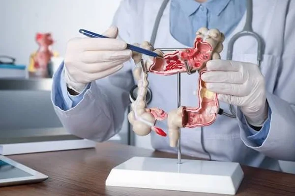 Stapled Transanal Rectal Resection