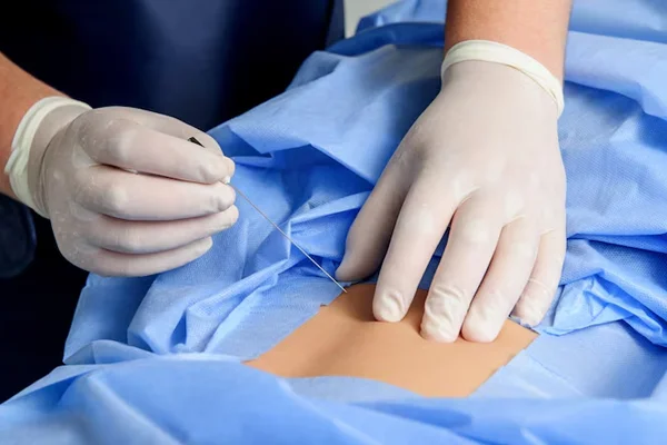 Minimal Access Surgery